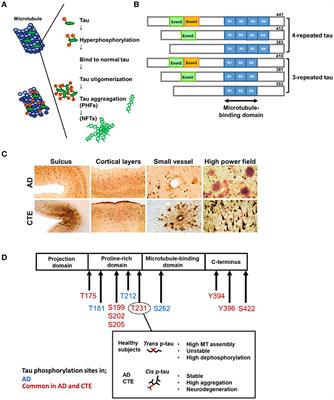 Tau Pathology in Chronic Traumatic Encephalopathy and Alzheimer's Disease: Similarities and Differences